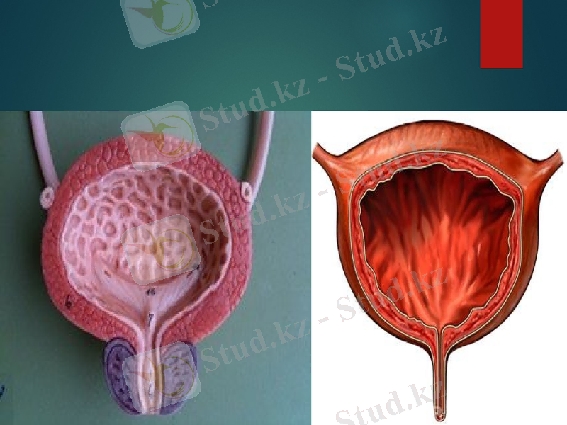 Slide 14