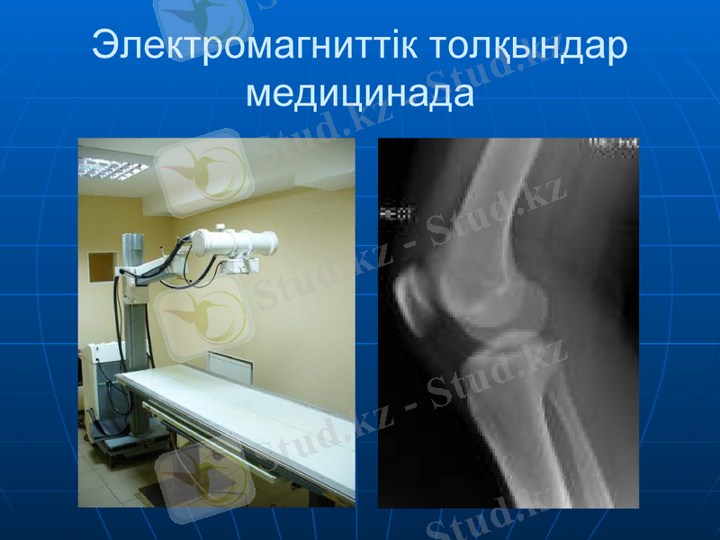 Slide 33
