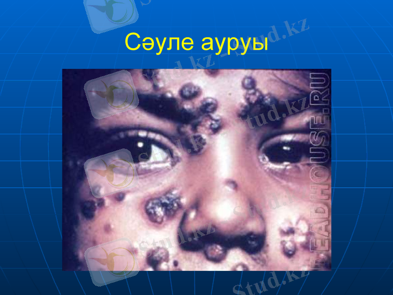 Slide 37
