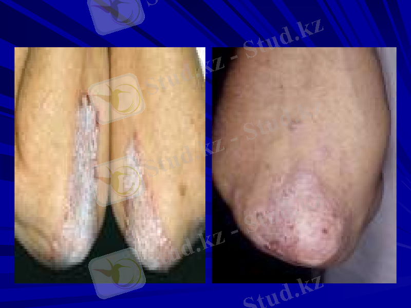 Slide 13