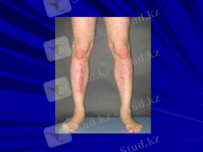 Slide 17