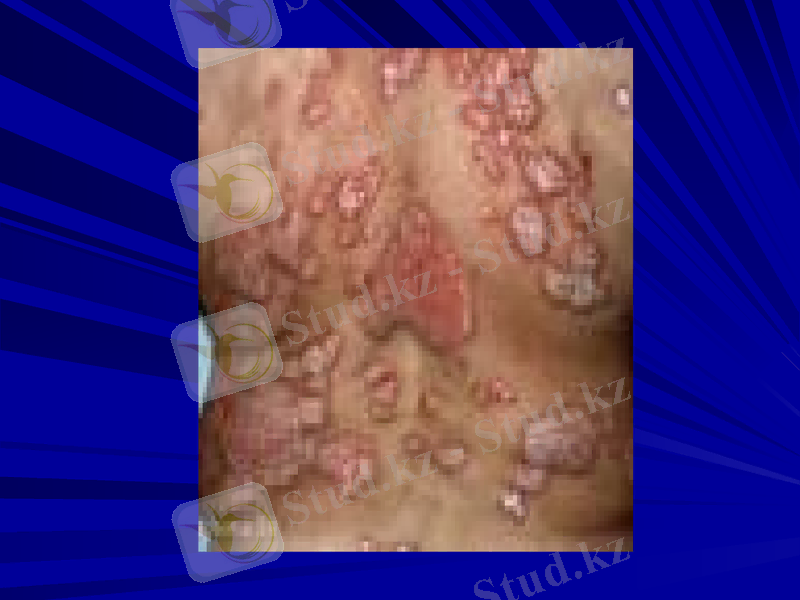 Slide 18