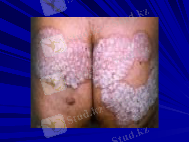 Slide 22