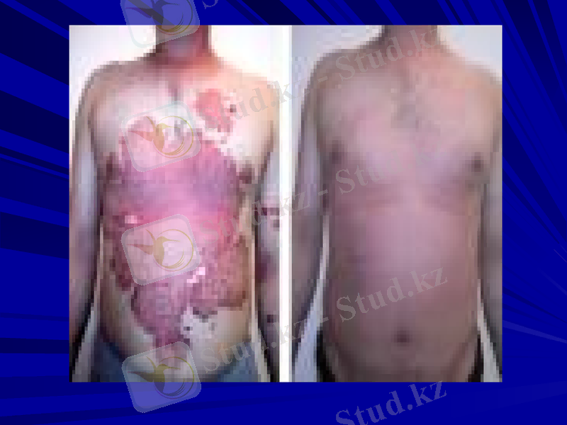 Slide 23