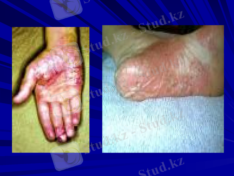 Slide 25