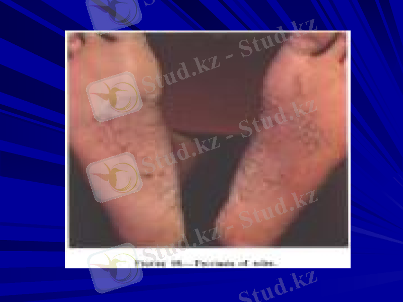 Slide 26