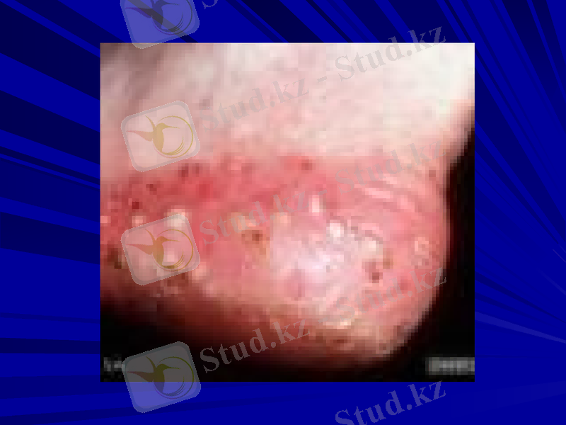 Slide 27