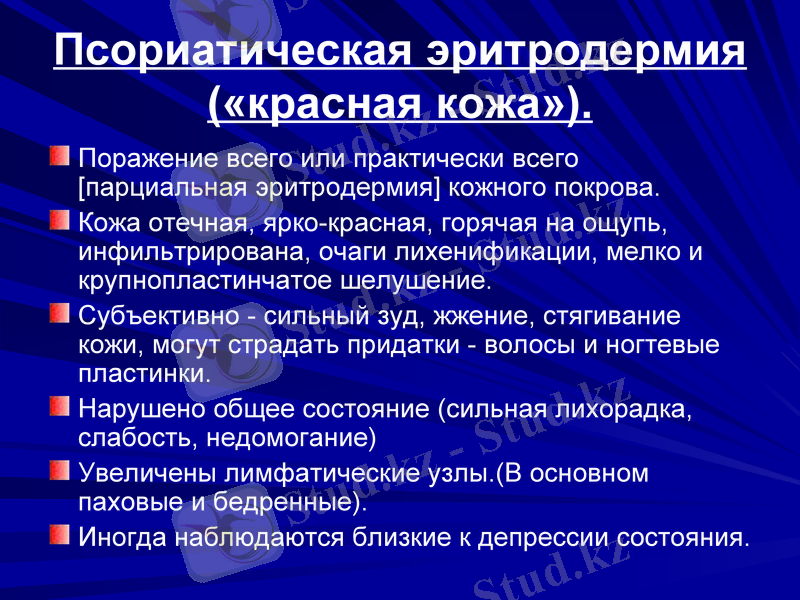 Slide 35