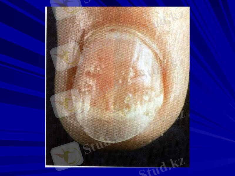 Slide 42