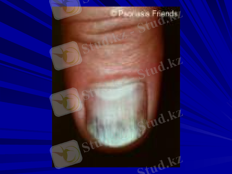 Slide 43