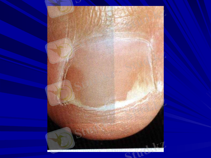Slide 44