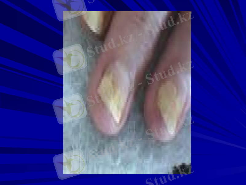 Slide 45