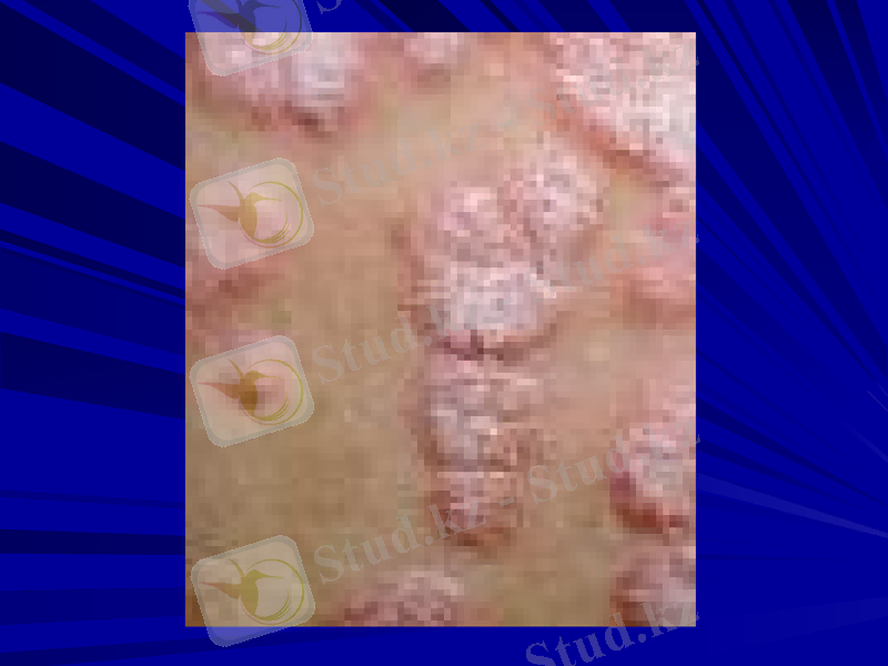Slide 7