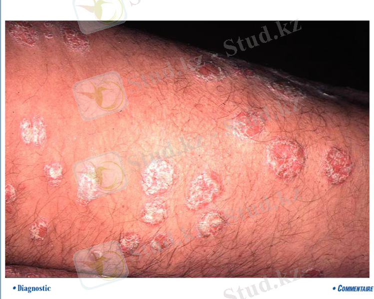Slide 8