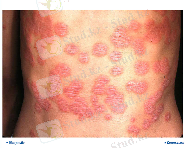 Slide 9