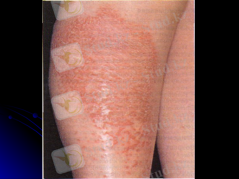 Slide 18
