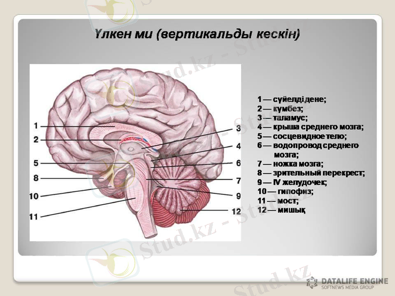 Slide 18