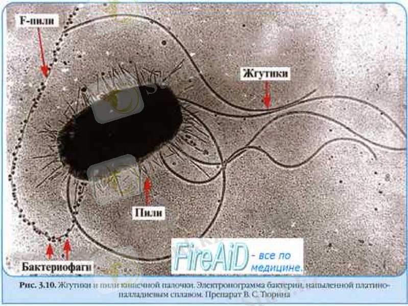 Slide 14