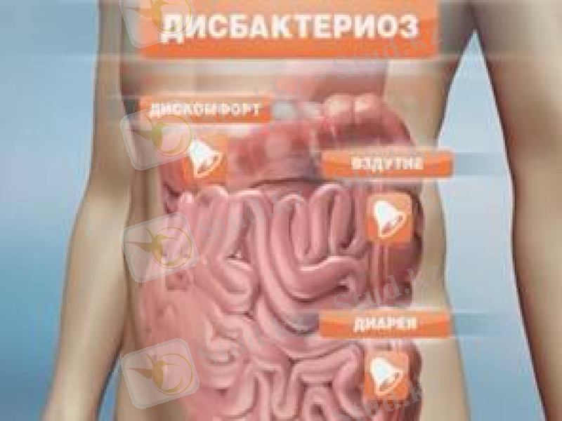 Slide 25
