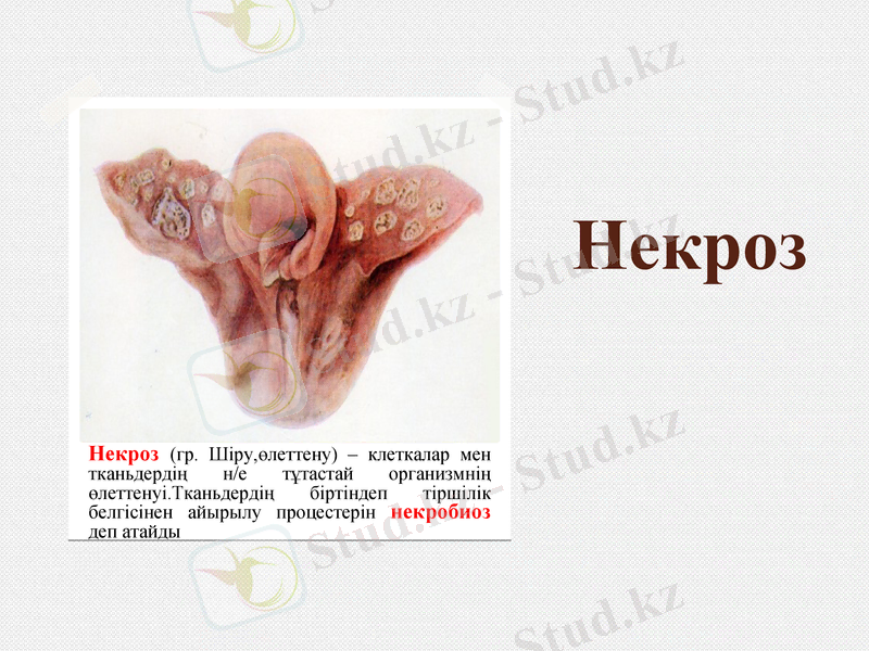 Slide 15