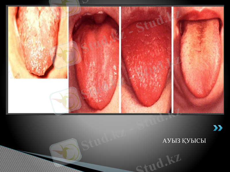 Slide 5