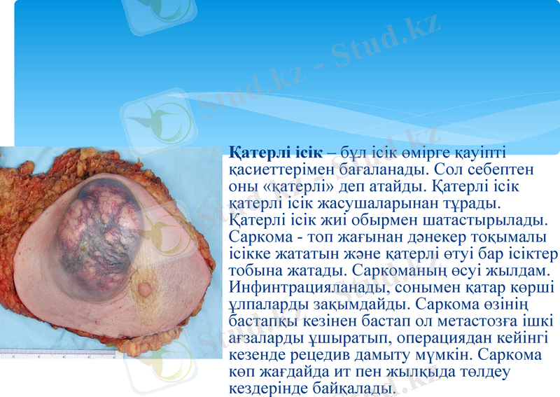 Slide 13