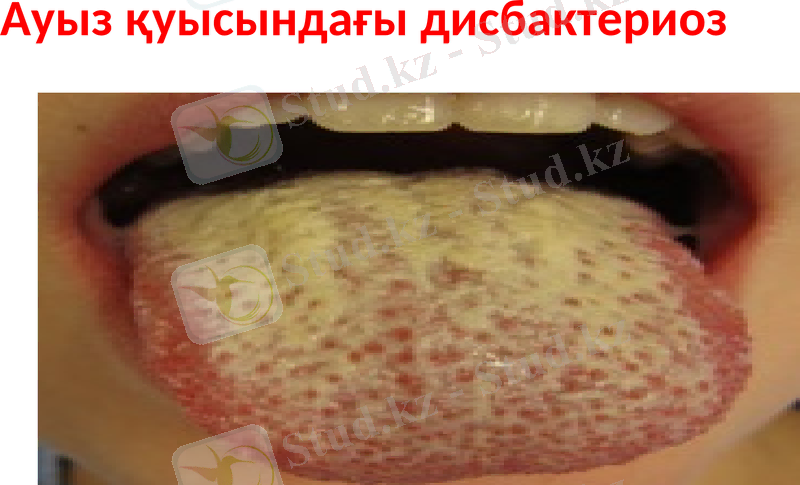 Slide 14