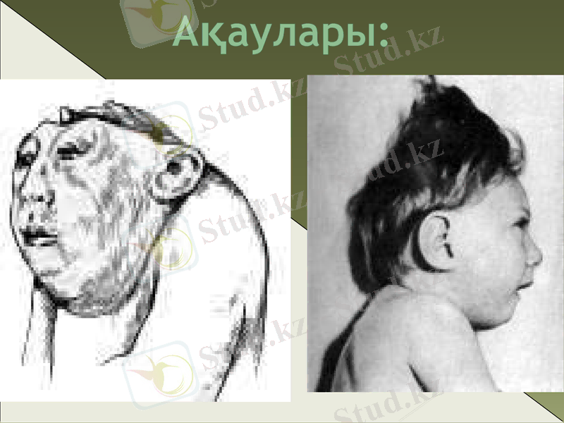 Slide 26