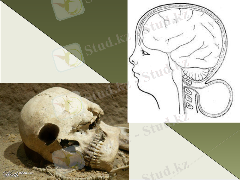 Slide 31