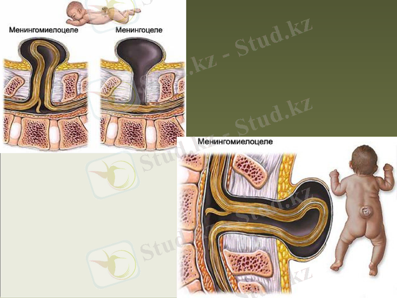 Slide 32