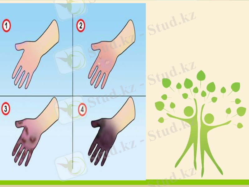 Slide 11