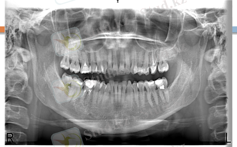 Slide 19