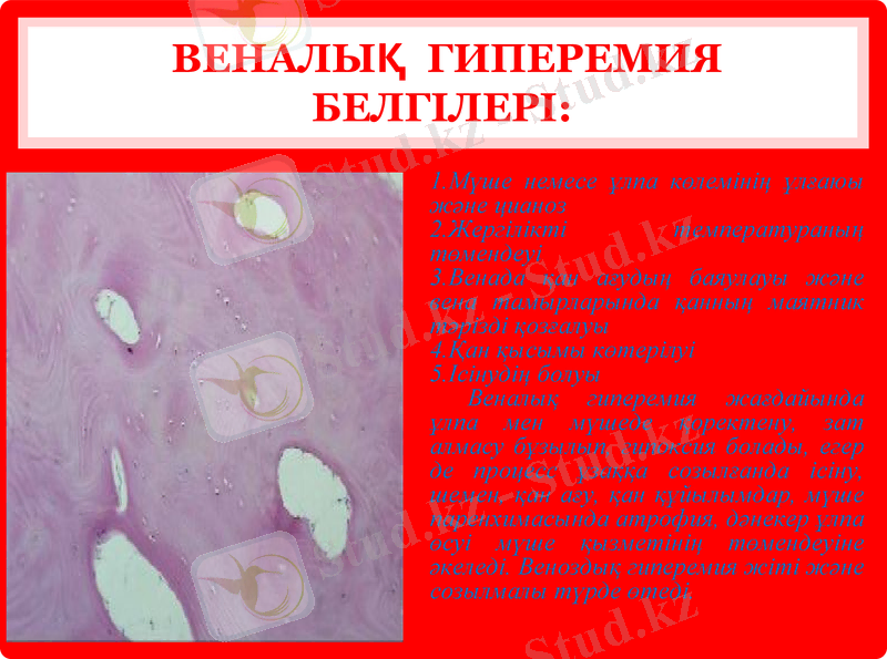 Slide 9