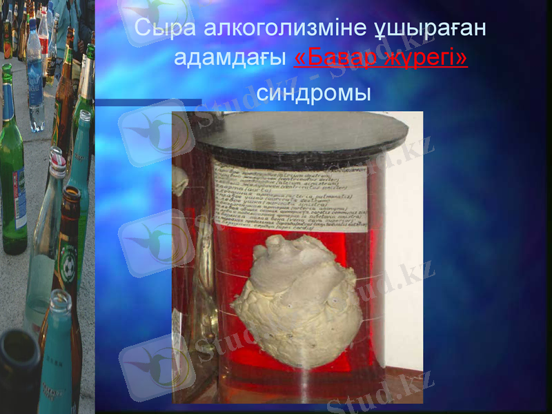Slide 15