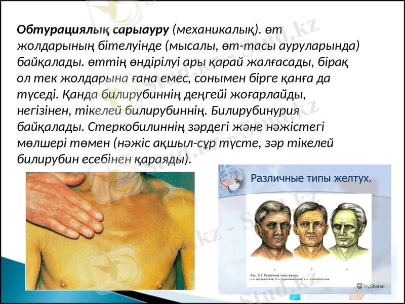 Slide 13