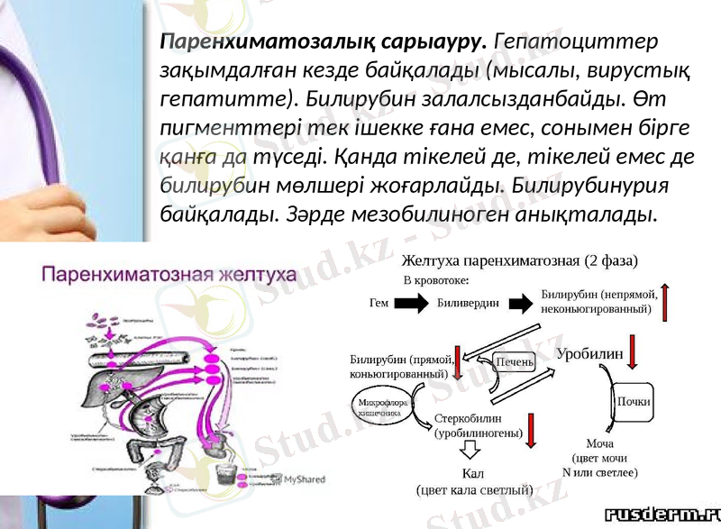 Slide 14
