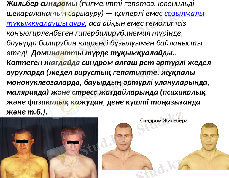Slide 15