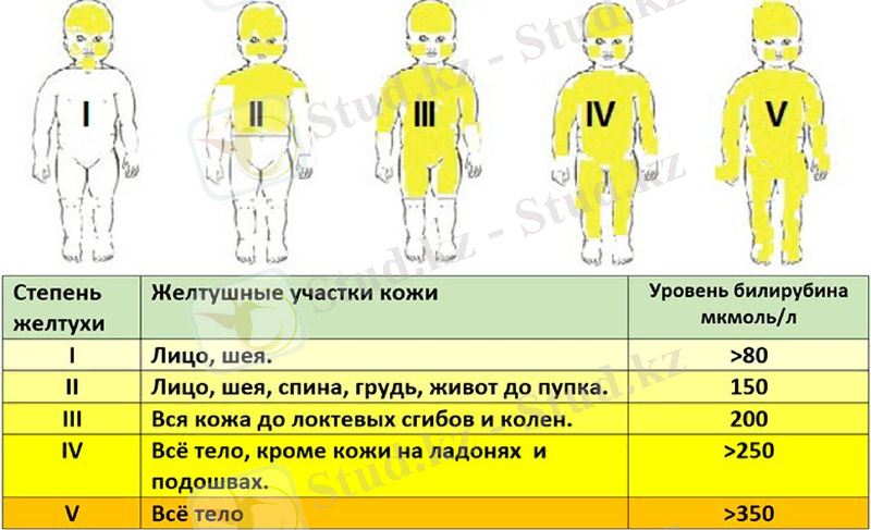Slide 19