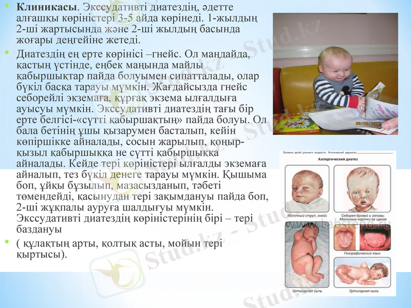 Slide 13