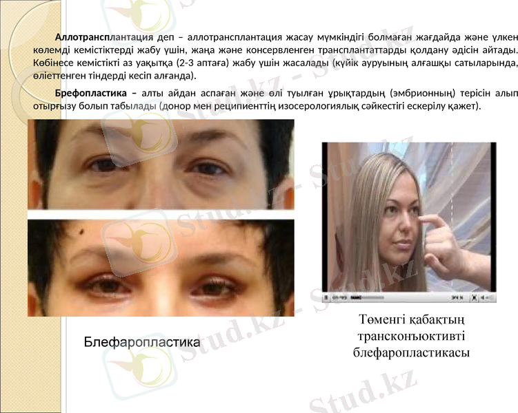 Slide 6