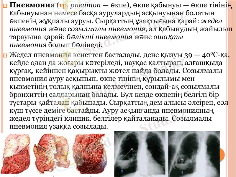 Slide 11