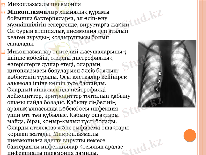 Slide 12