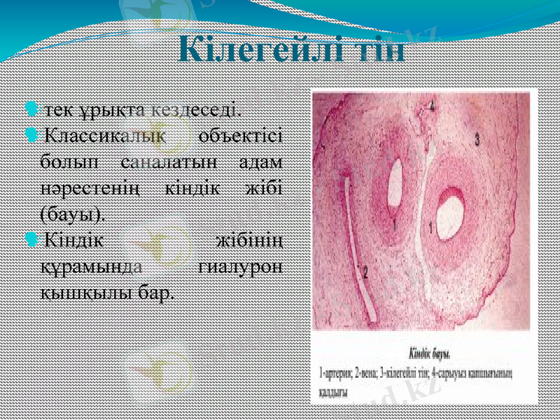 Slide 11