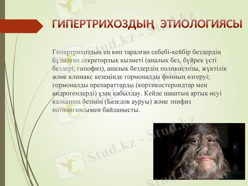 Slide 7