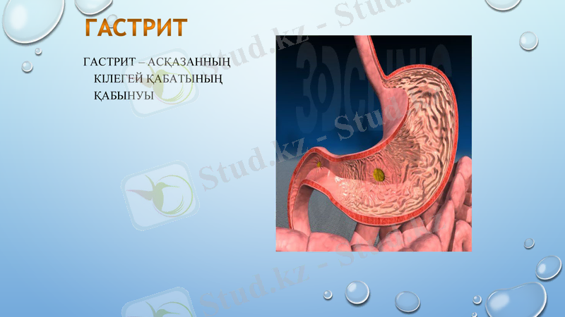 Slide 9