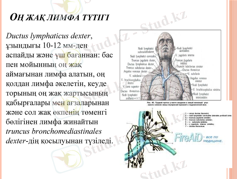 Slide 14