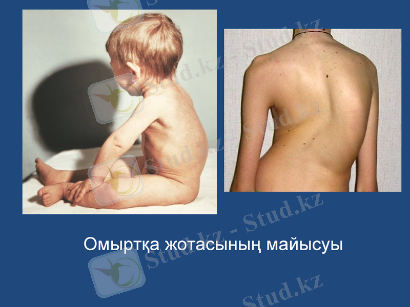 Slide 18