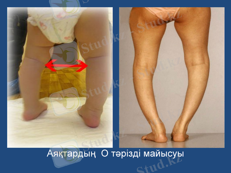 Slide 20