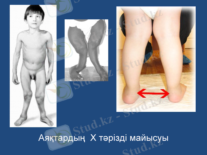 Slide 21