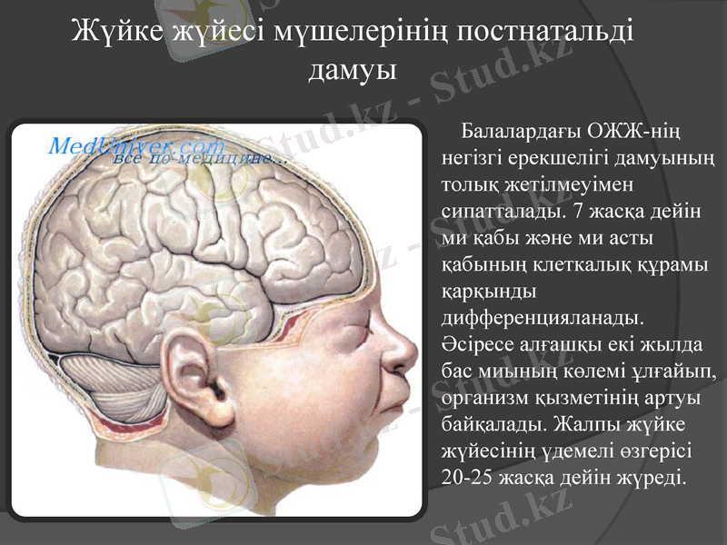 Slide 11